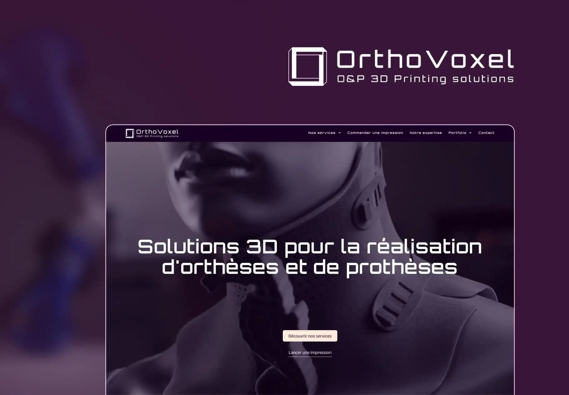 Projet Orthovoxel — Thimoo